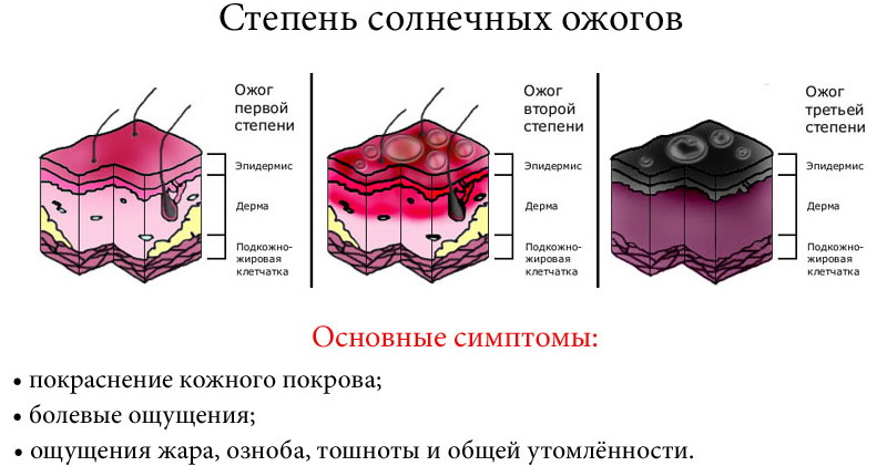 Солнечный ожог картинки