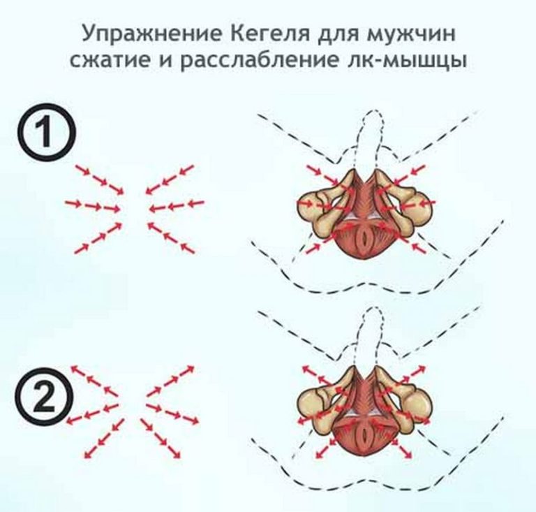 Упражнения кегеля с картинками