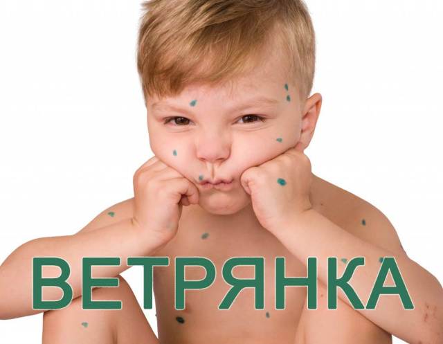 Wind shempar: symptoms, signs, diagnostics, photos. Treatment and prevention of chickenpox in adults and children. How the windshield is transmitted, the incubation period. Vaccination from chickenpox, why make vaccination