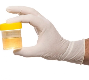 Que meios fosfatos na urina - causas, sintomas, diagnóstico. fosfatos destaque na urina em adultos, crianças, mulheres grávidas. Tratamento de fosfatos na urina. Características da dieta com fosfatos na urina