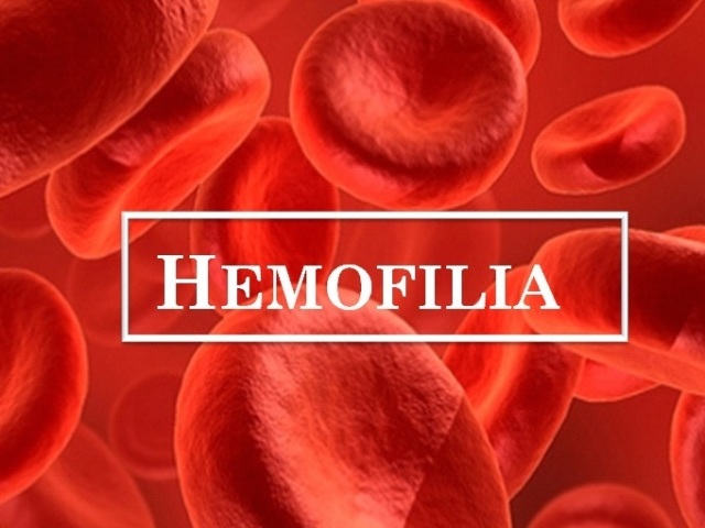 Hemophilia คืออะไร - สาเหตุสัญญาณการวินิจฉัย การรักษาฮีโมฟีเลียในผู้ใหญ่และเด็ก ฮีโมฟีเลียเป็นอย่างไรผู้ให้บริการ