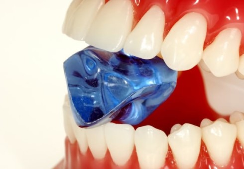 Penyebab penampilan dan bahaya batu gigi untuk seseorang. Cara menghapus batu gigi di rumah. Agen pembersih gigi
