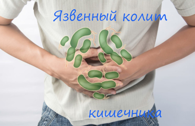 Simptomi ulceroznog crijeva. Liječenje ulceraznih colesha u odraslih i djece. Ljudski tretman ulceroznog crijeva. Dijeta i prehrana s ulcerativnim kolicima
