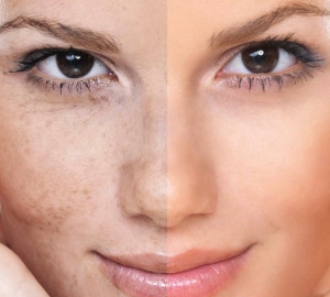 Hur man förbättrar ansiktet i ansiktet snabbt hemma. Fonder, vitaminer och produkter som förbättrar huden. Hemlagad masker för att förbättra ansiktsfärgen