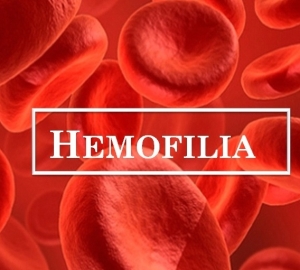 Co je hemofilie - příčiny, znamení, diagnostika. Léčba hemofilie u dospělých a dětí. Jak je Hemofilie, která je dopravci