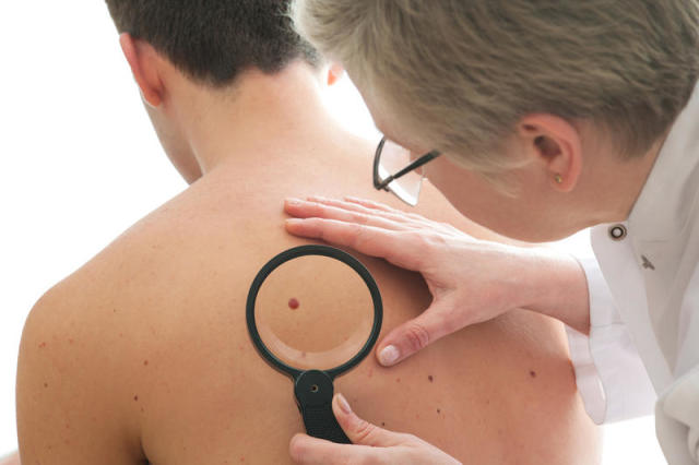 O que o vermelho moles no corpo em adultos e crianças significa. Causas da aparência e tipos de moles vermelhos no corpo. Os pontos vermelhos são perigosos no corpo, como moles? Como se livrar de moles vermelhos, remoção