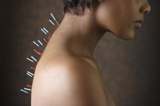 Acupunctură - indicații și contraindicații. Tratamentul acupuncturii