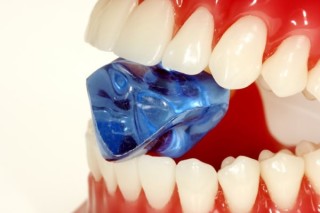 Причины появления и вред зубного камня для человека. Как удалить зубной камень в домашних условиях. Средства для чистки зубного камня