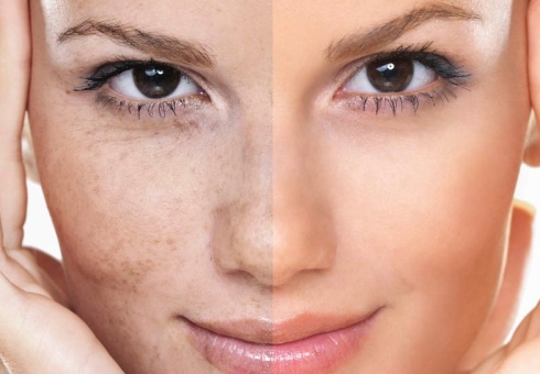 Hur man förbättrar ansiktet i ansiktet snabbt hemma. Fonder, vitaminer och produkter som förbättrar huden. Hemlagad masker för att förbättra ansiktsfärgen