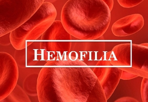 What is hemophilia - causes, signs, diagnostics. Treatment of hemophilia in adults and children. How is hemophilia, who is carriers