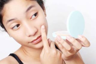 Pomáhá zinek masti akné na obličeji. Jak používat zinku masti z akné a skvrn po akné - návod k použití