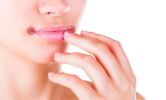 Saws on the lips are the causes of the appearance of what is missing. How to treat snags on lips in adult and baby