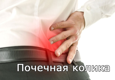 Causes, symptoms and diagnosis of renal colic in men and women. First aid with renal colic, how to remove pain. Methods for the treatment of kidney colic in adults, children and pregnant women