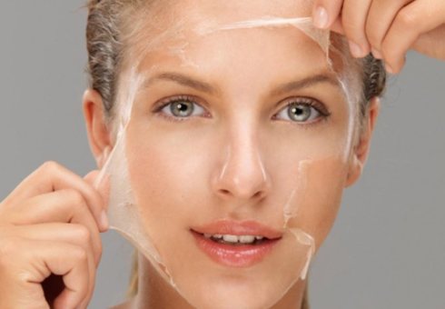 TCA peeling for cleansing the skin of the face. How chemical peeling TSA is carried out in salon and home environment. Skin Care after TSA Peeling