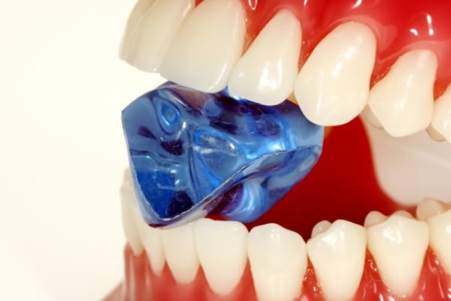 Cauze ale aspectului și a răului unei pietre dentare pentru o persoană. Cum să eliminați piatra dentară la domiciliu. Agenți de curățare dentară