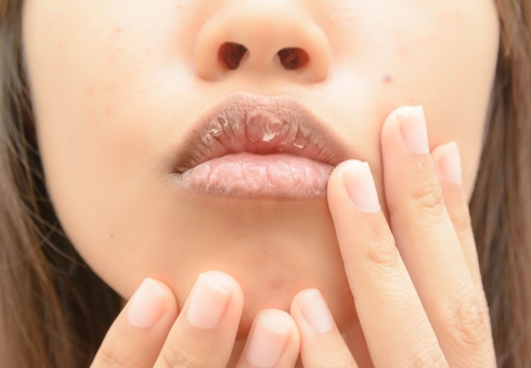 Почему сохнут и трескаются губы — причины. Что делать, если губы сохнут