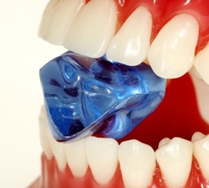 Uzroci izgleda i štete za stomatološki kamen. Kako ukloniti stomatološki kamen kod kuće. Sredstva za čišćenje zuba