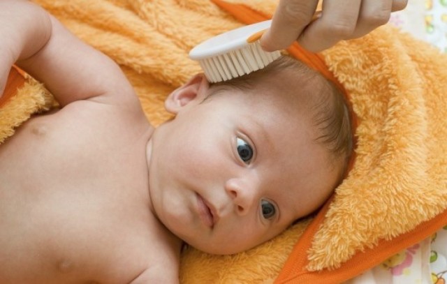 Когда и почему появляются корочки на голове у новорожденного. Как убрать желтые корочки на голове, бровях, лице новорожденного